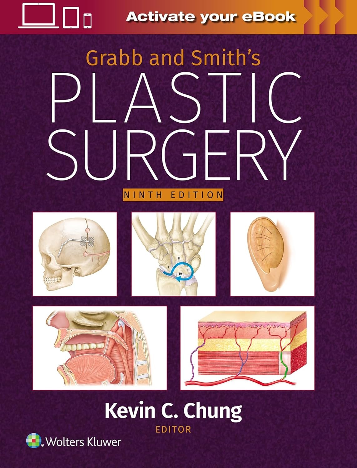 Grabb and Smith's Plastic Surgery 9th Edition 2025 Premium Multicolor Mate Print