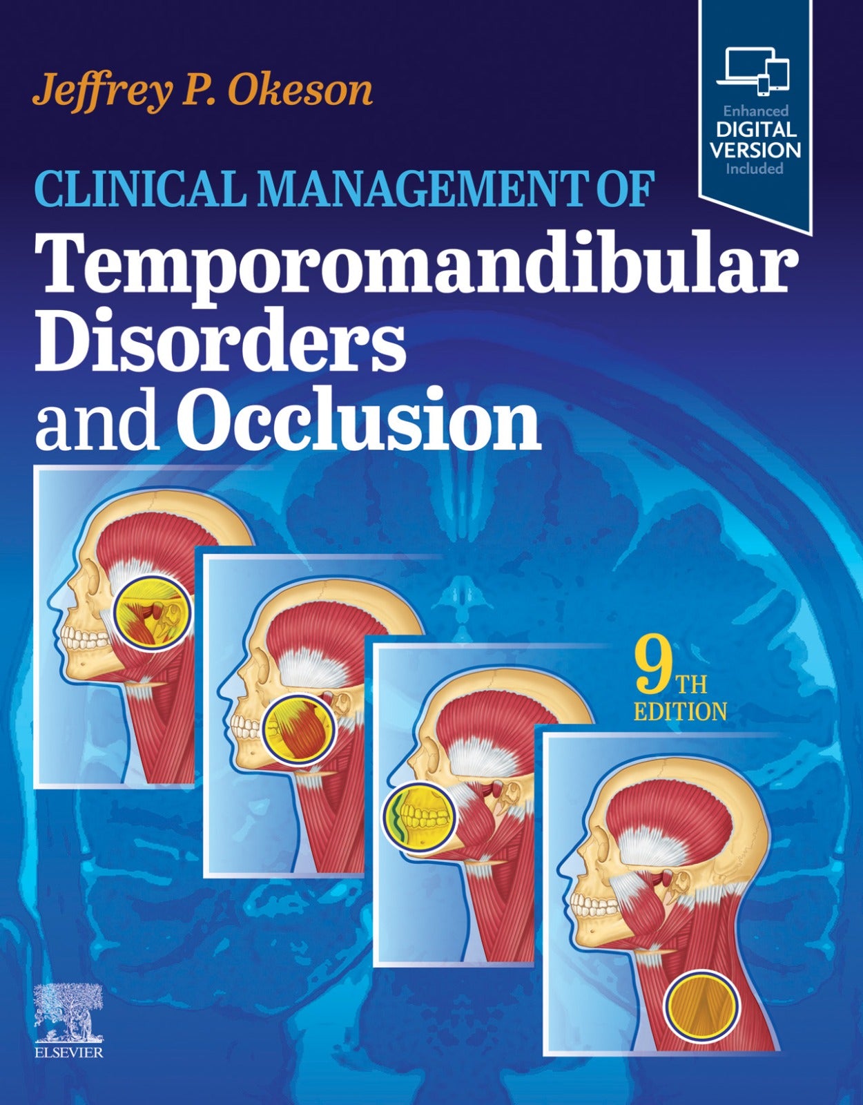 Temporomandibular Disorders and Occlusion (Premium Multicolor Matte Finish)