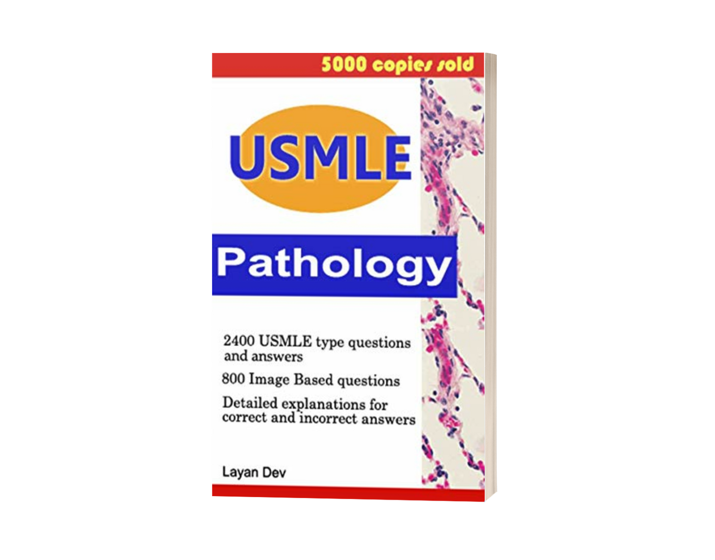 USMLE Flashcards Pathology