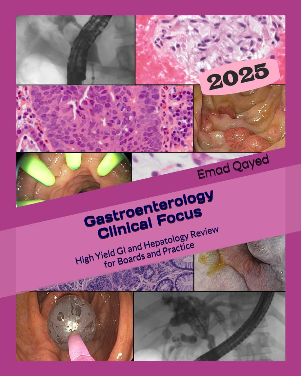 Gastroenterology Clinical Focus: High yield GI and hepatology review- for Boards and Practice - 3rd edition 2025