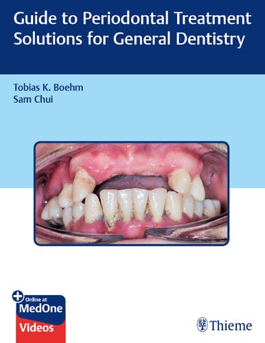Guide to Periodontal Treatment Solutions for General Dentistry Javed Books