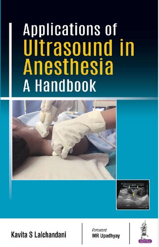 Applications of Ultrasound in Anesthesia A Handbook