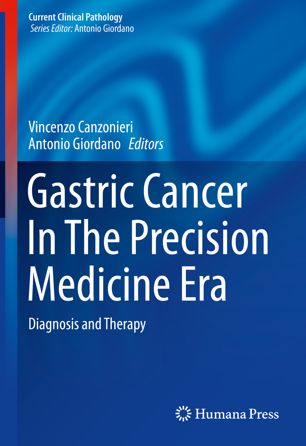 Gastric Cancer In The Precision Medicine Era: Diagnosis and Therapy Javed Books