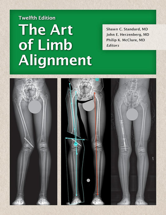 The Art of Limb Alignment 12th Edition Premium Multicolor Matte Print Javed Books