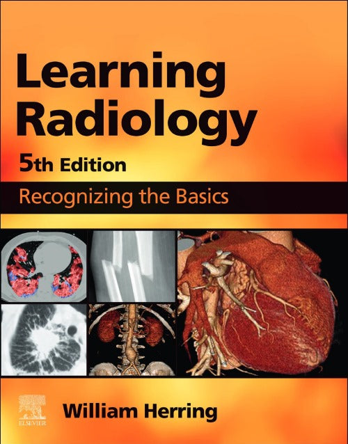 Learning Radillogy Learning Radiology: Recognizing the Basics 5th Edition 2023 – zmsbooks