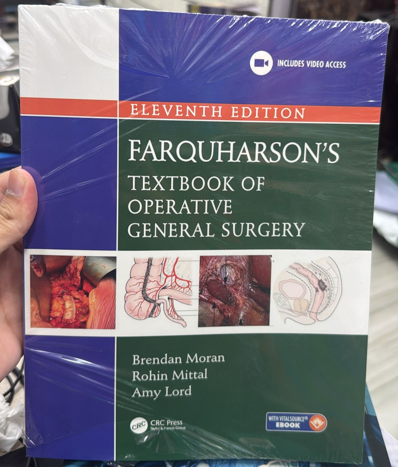 Farquharson's Textbook of Operative General Surgery 11th Edition 2026 Premium Multicolor Mate Print (Original)