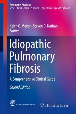 Idiopathic Pulmonary Fibrosis: A Comprehensive Clinical Guide Javed Books